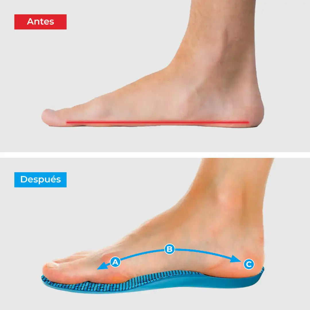 Plantillas ComfyFeet™ - Disfruta de Días Sin Dolor, Sin Tratamientos Caros y Sin Visitas al Médico